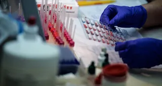 Капитал - В РК остаются неизведанными сотни очагов сибирской язвы