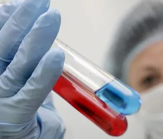 Капитал - Лечение одного пациента от ВИЧ/СПИД стоит $2 тыс.