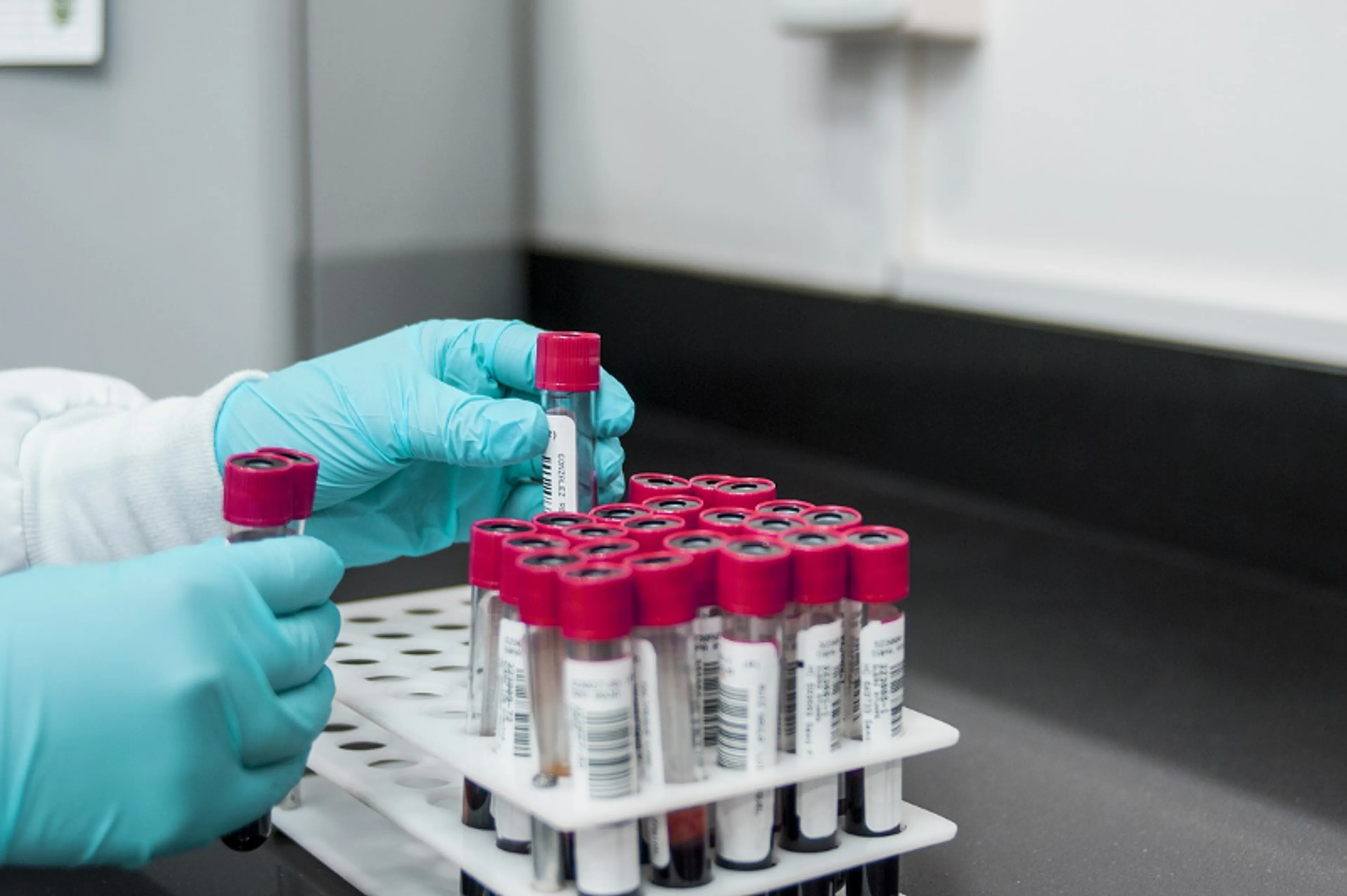 Капитал - Третий случай заражения коронавирусом выявлен в Казахстане