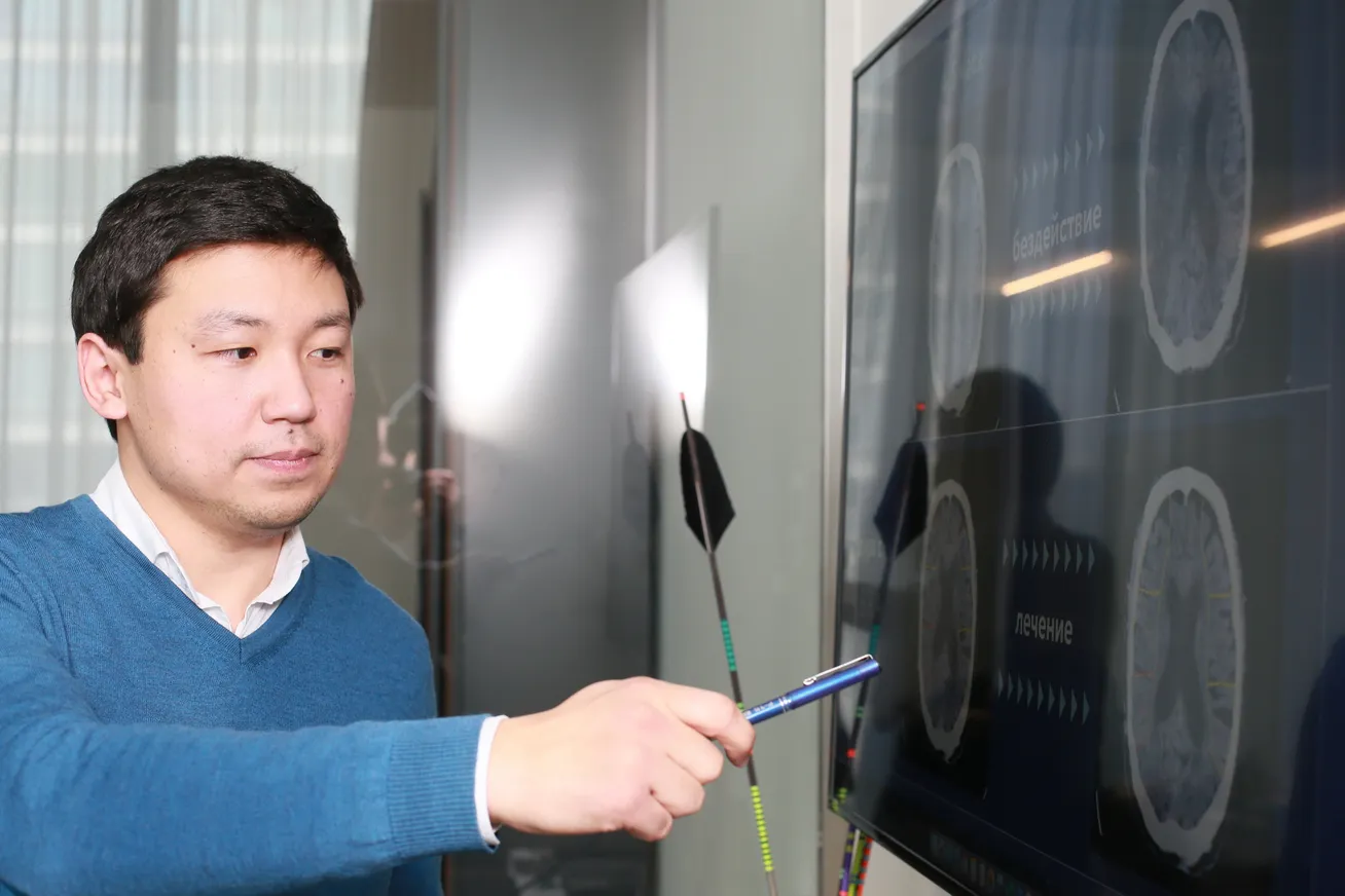 Все полутона серого: искусственный интеллект против ишемии - фото kapital.kz