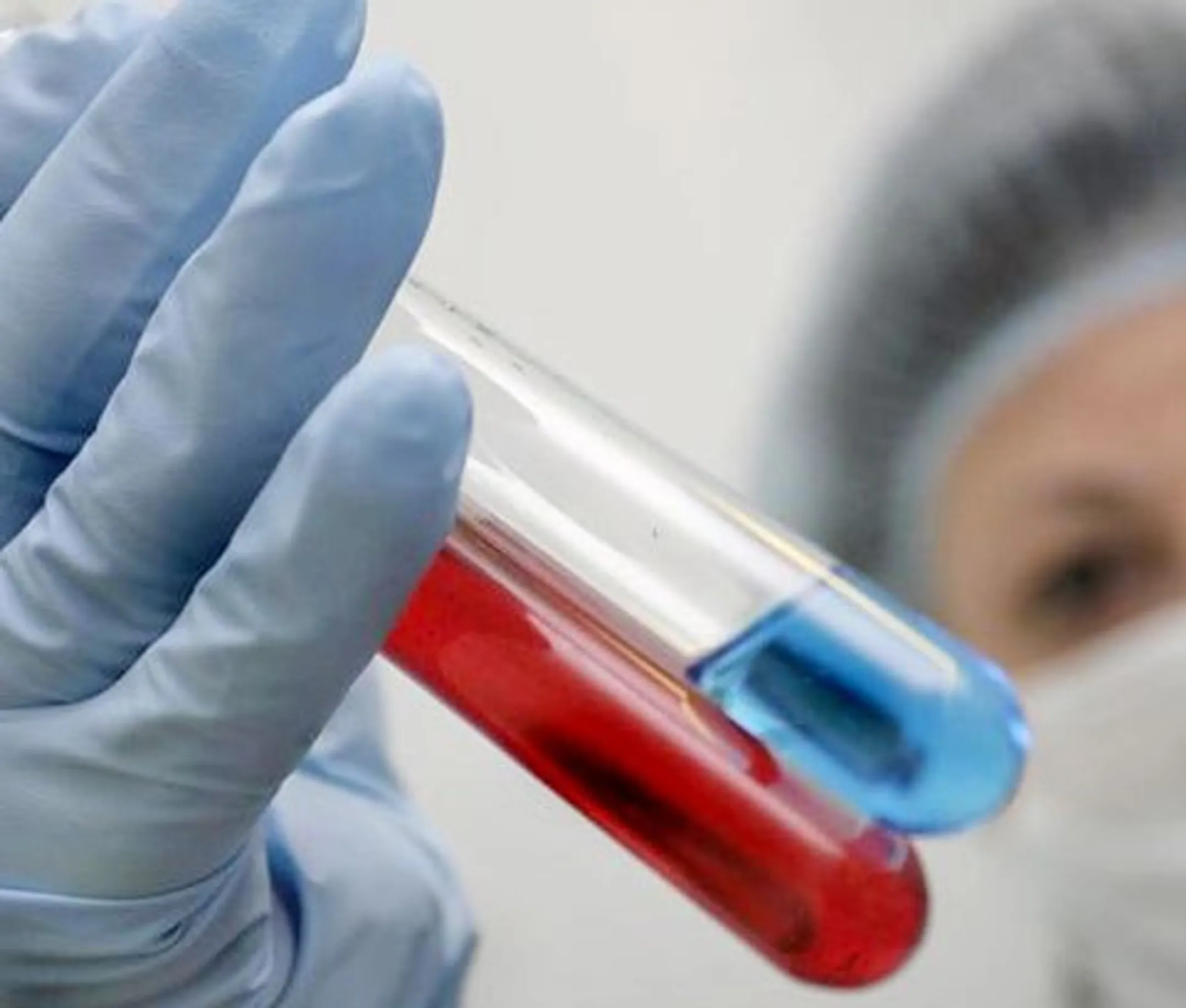 Лечение одного пациента от ВИЧ/СПИД стоит $2 тыс. - Image Kapital.kz