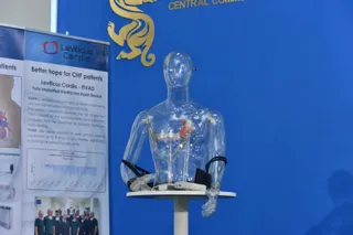 Капитал - В Астане впервые в мире имплантировали искусственное сердце