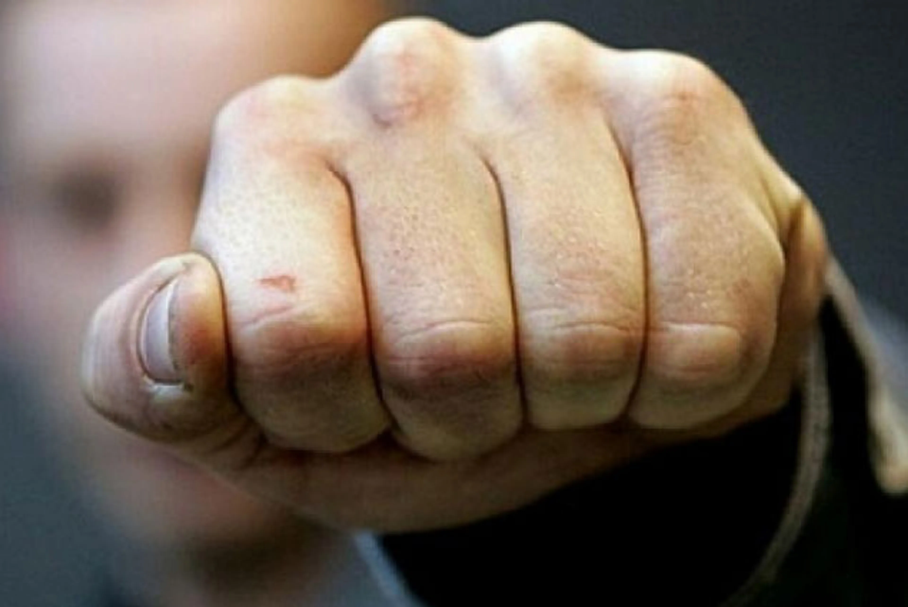 Капитал - 31 человек пострадал в драке на месторождении в ВКО