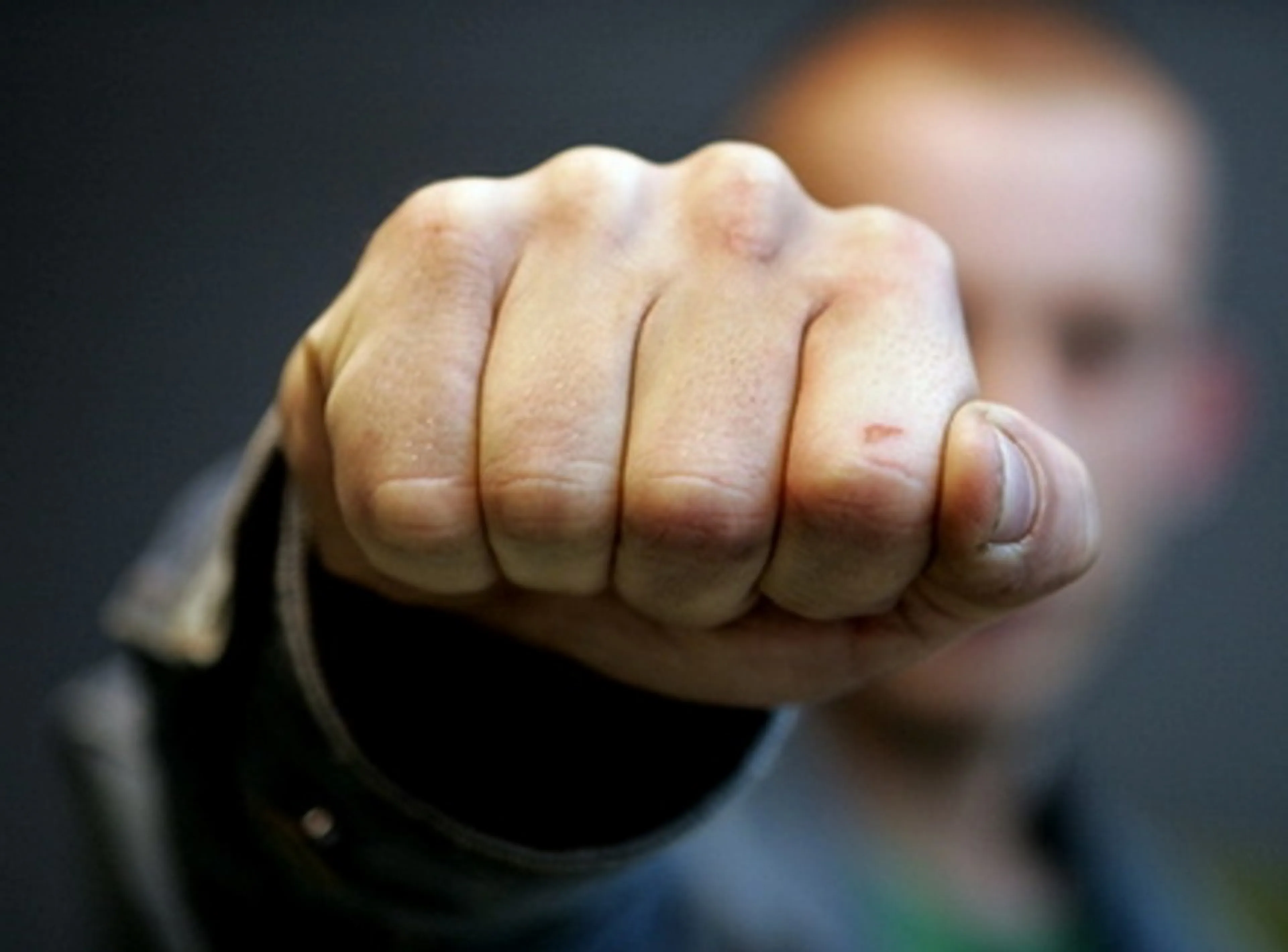 Капитал - В Шымкенте бизнесмена подозревают в жестоком избиении парня