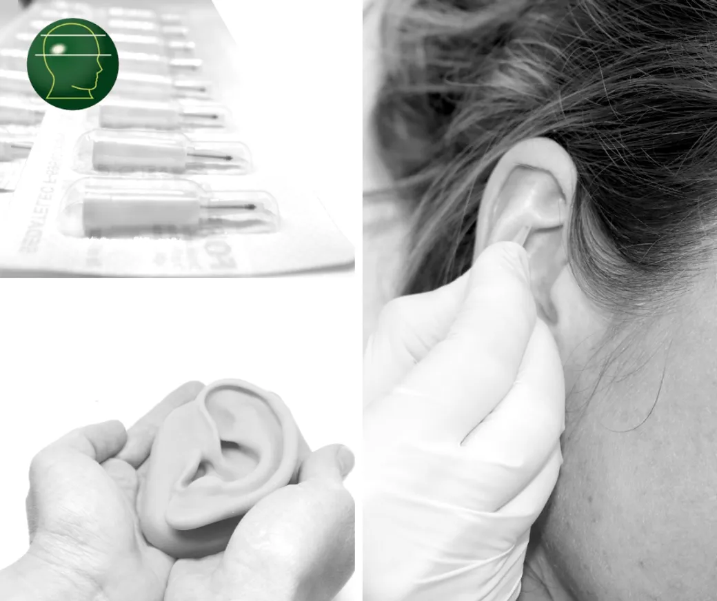 Как метод «вечной иглы» помогает в лечении тяжелых заболеваний - фото kapital.kz