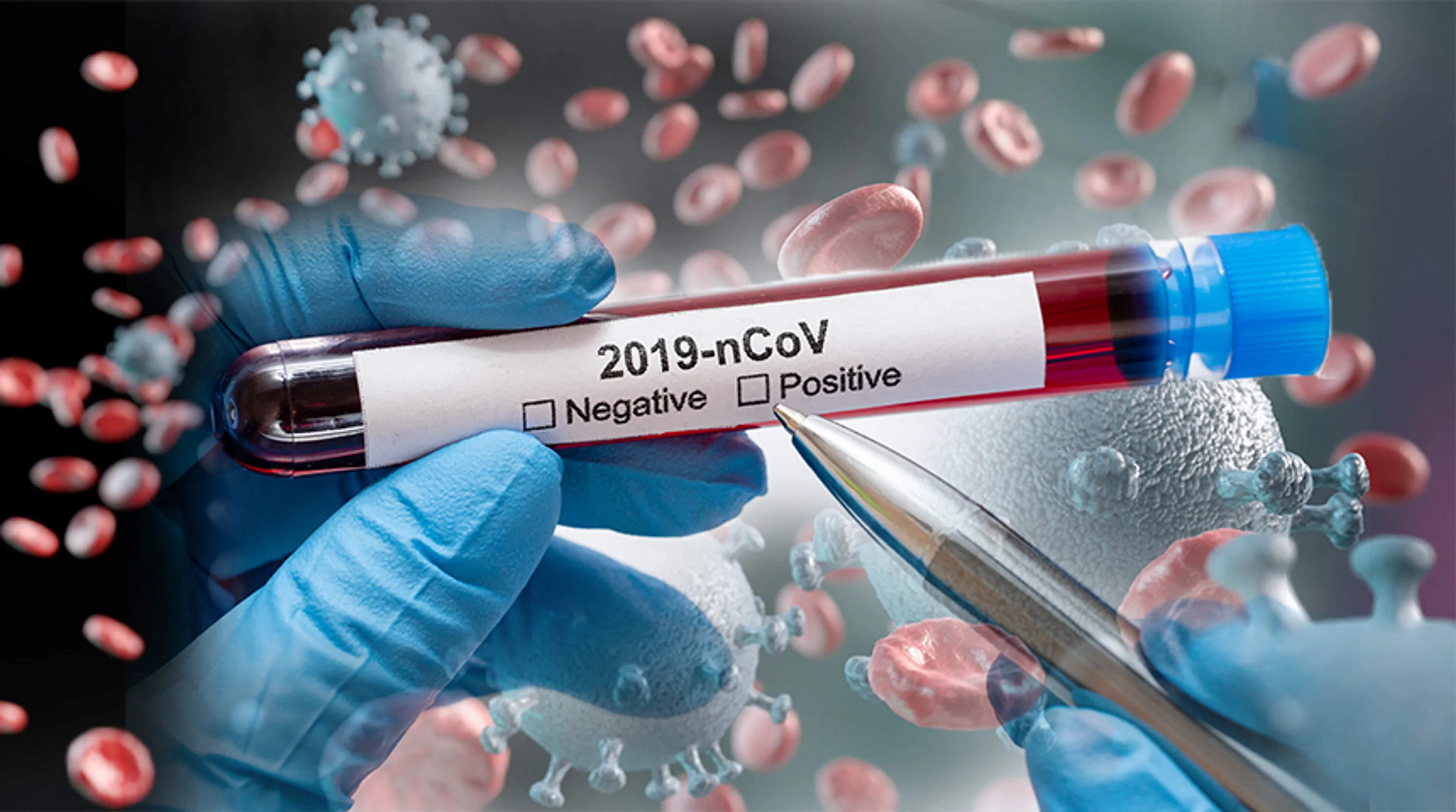 Капитал - В июне от пневмонии умерли 628 казахстанцев