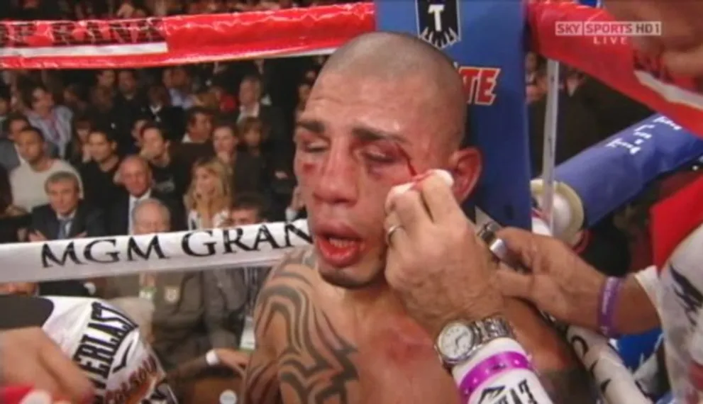 Капитал - Боб Арум не советует Мигелю Котто боксировать с Головкиным