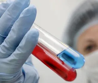 Лечение одного пациента от ВИЧ/СПИД стоит $2 тыс.