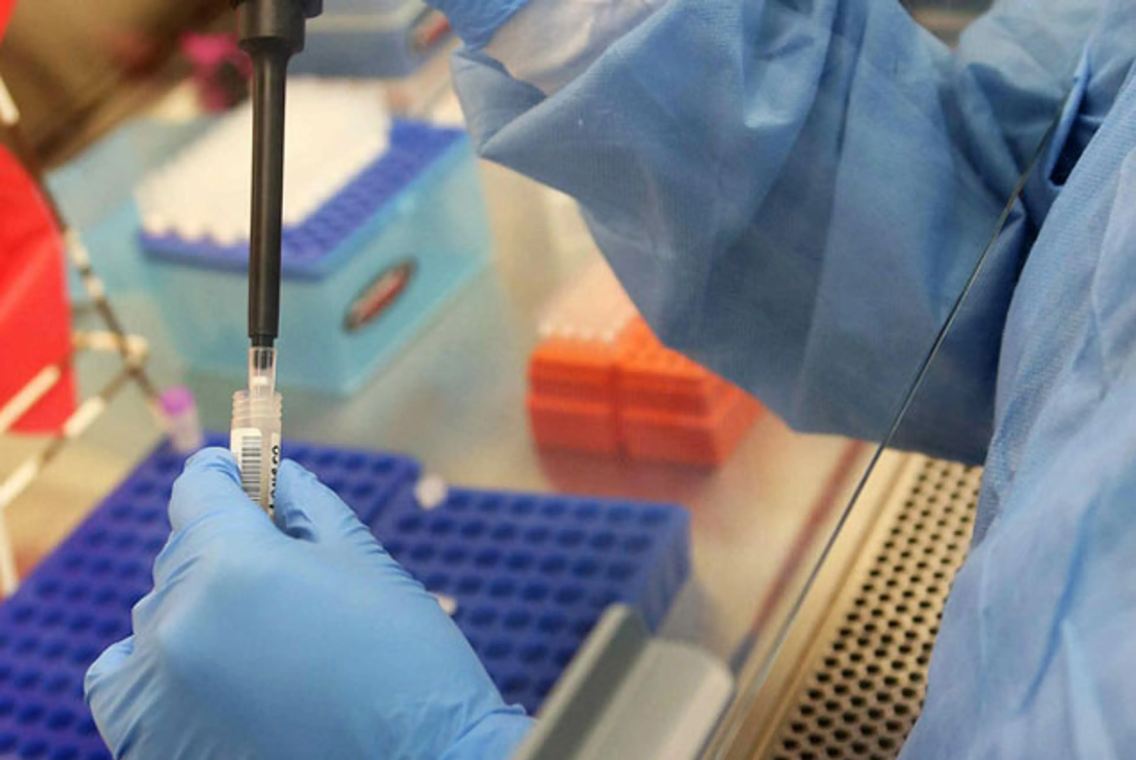 Капитал - В РФ зафиксирован первый случай заболевания вирусом Зика