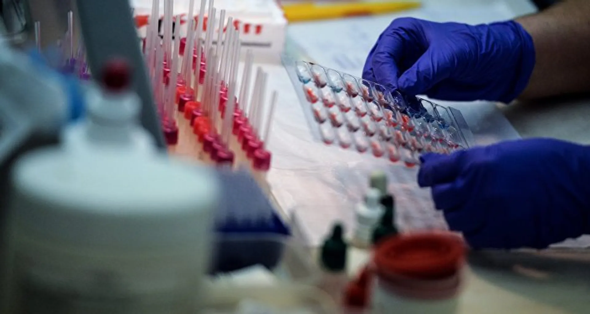 Капитал - В РК остаются неизведанными сотни очагов сибирской язвы