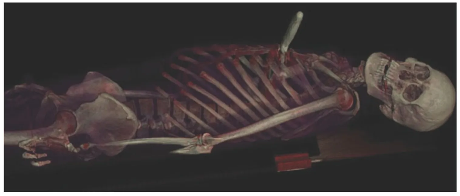 O’Reilly Media: Компьютерный снимок умершего от ранения ножом