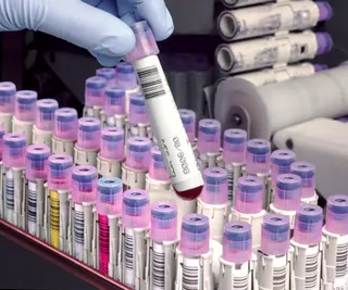 Капитал - Мировые богачи вложились в диагностику рака